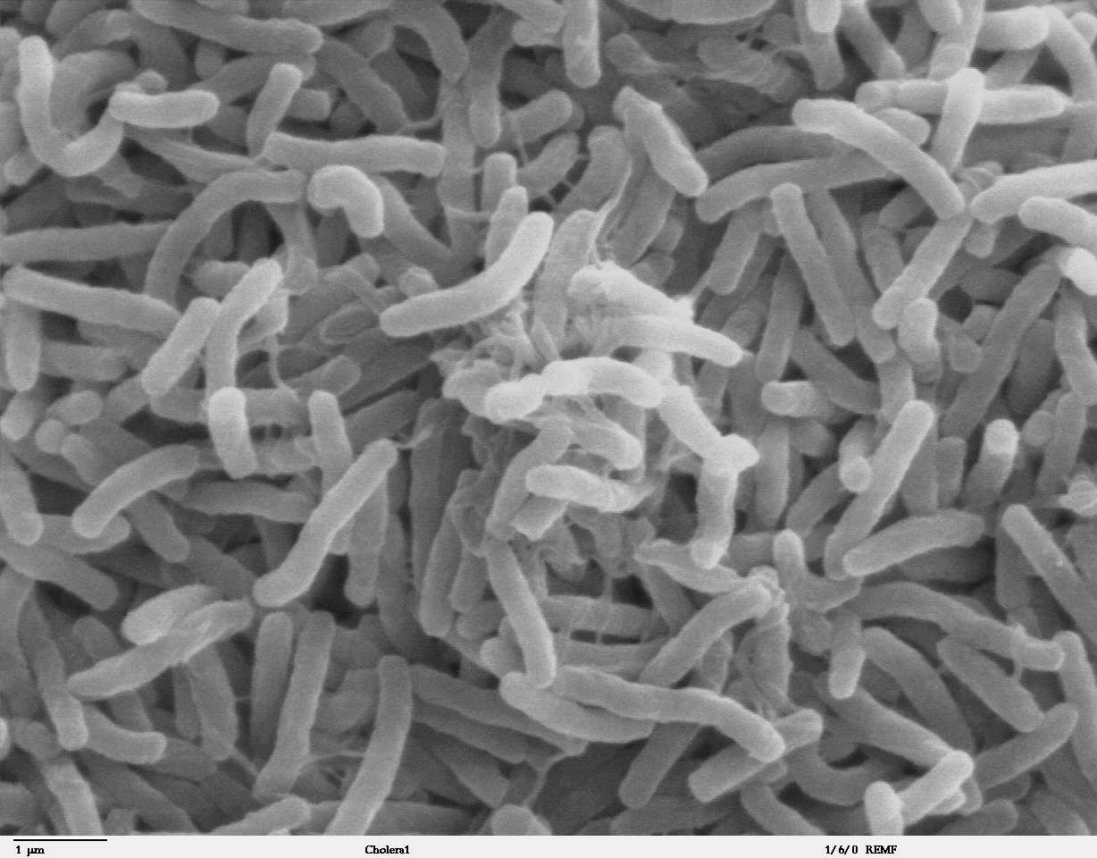 http://medicinabasica.com/wp-content/uploads/2020/11/Cholera_bacteria_SEM.jpg