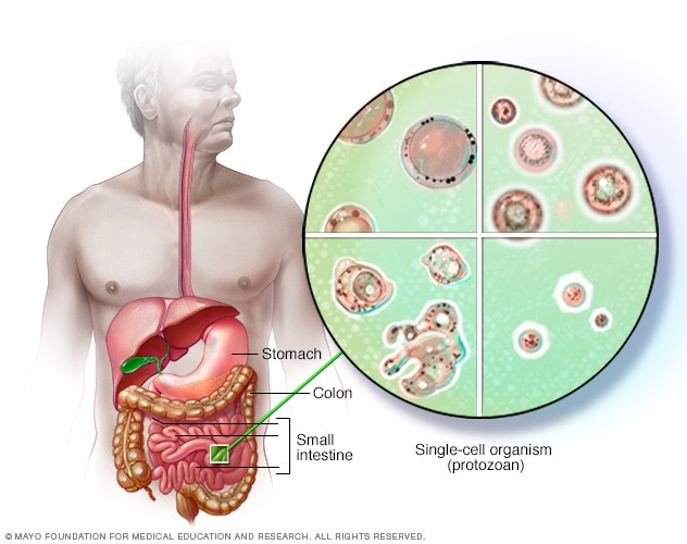 Blastocystis hominis: causas, síntomas y tratamiento