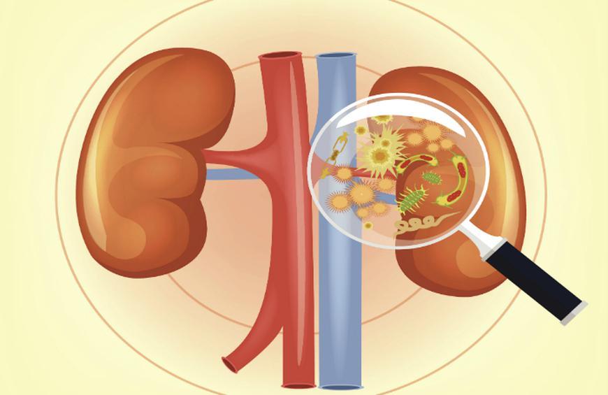 Infección renal: síntomas, causas y tratamiento.