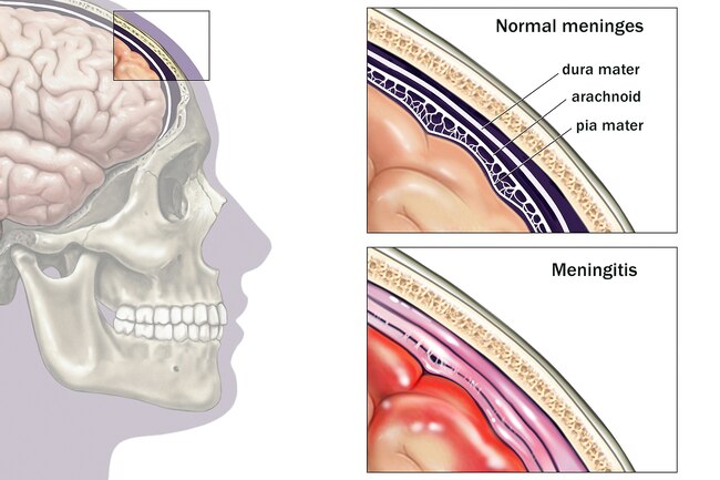 https://medicinabasica.com/wp-content/uploads/2020/12/1800ss_medicalimages_rm_brain_meninges_illustration.jpg