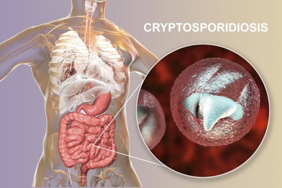 Infección por Cryptosporidium: síntomas y tratamiento